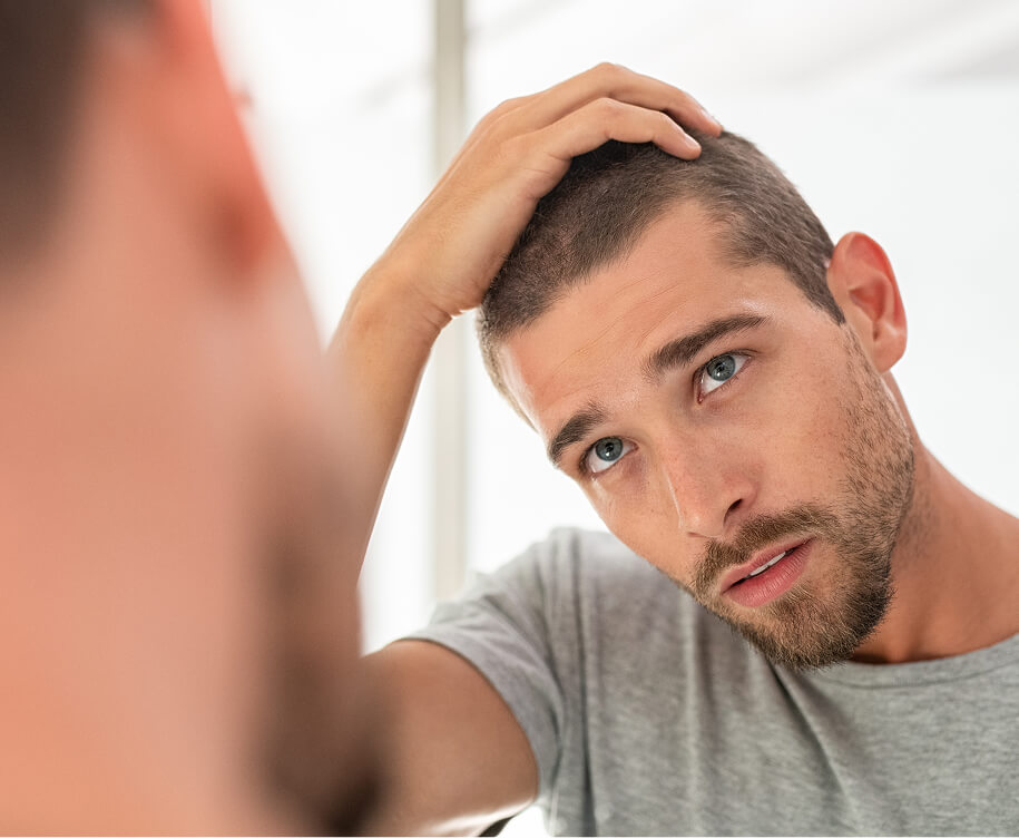 man-hair-loss